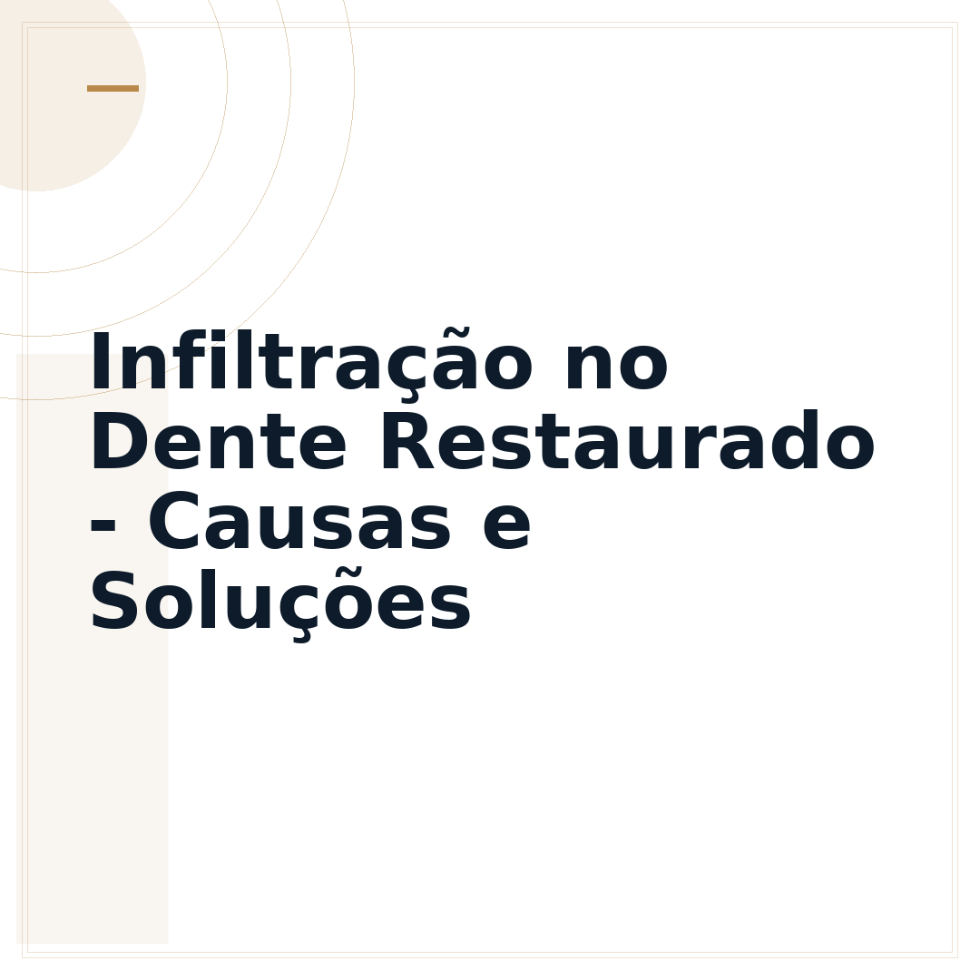 Infiltração no Dente Restaurado - Causas e Soluções