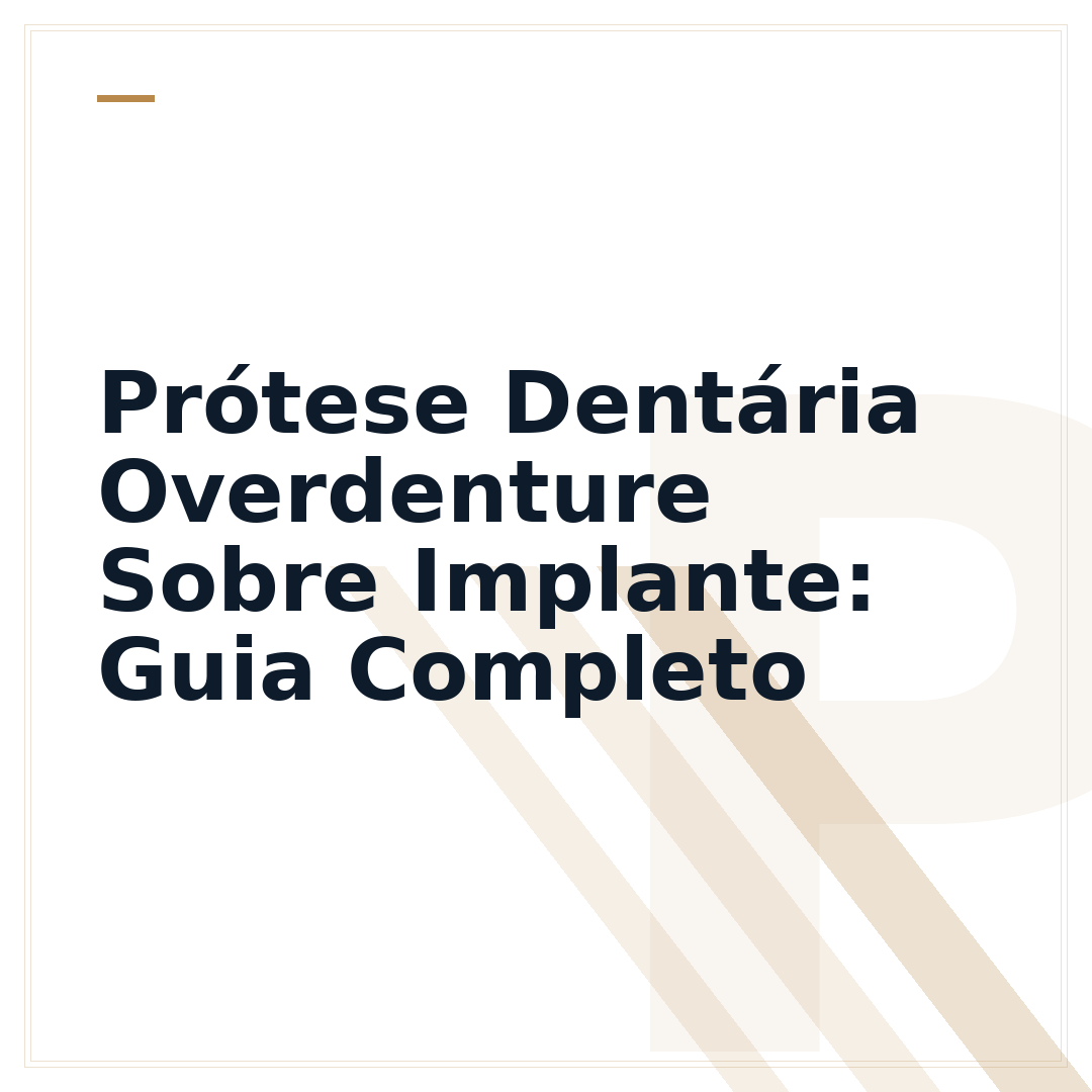 Prótese Dentária Overdenture Sobre Implante: Guia Completo